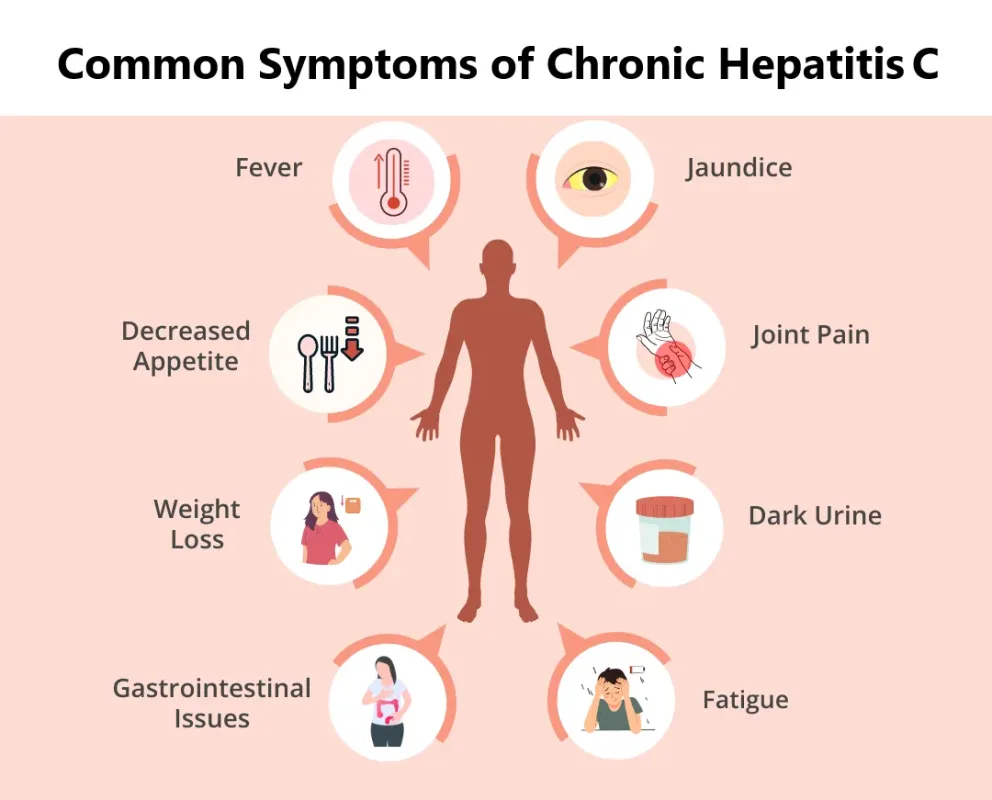 Is Chronic Hepatitis C Curable? Discover 6 Vital Facts 3 hep c symptoms