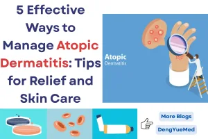 5 effective ways to manage atopic dermatitis tips for relief and skin care