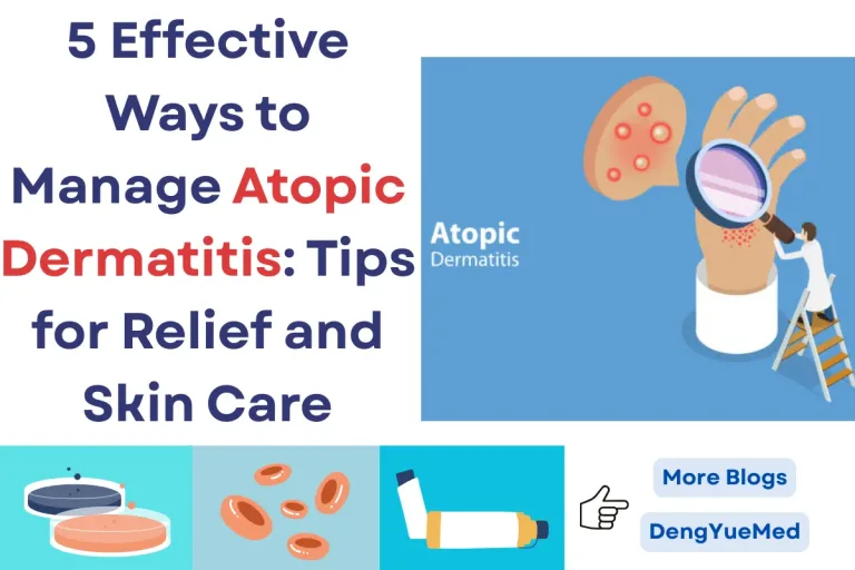 5 Effective Ways to Manage Atopic Dermatitis: Tips for Relief and Skin Care 5 Effective Ways to Manage Atopic Dermatitis: Tips for Relief and Skin Care