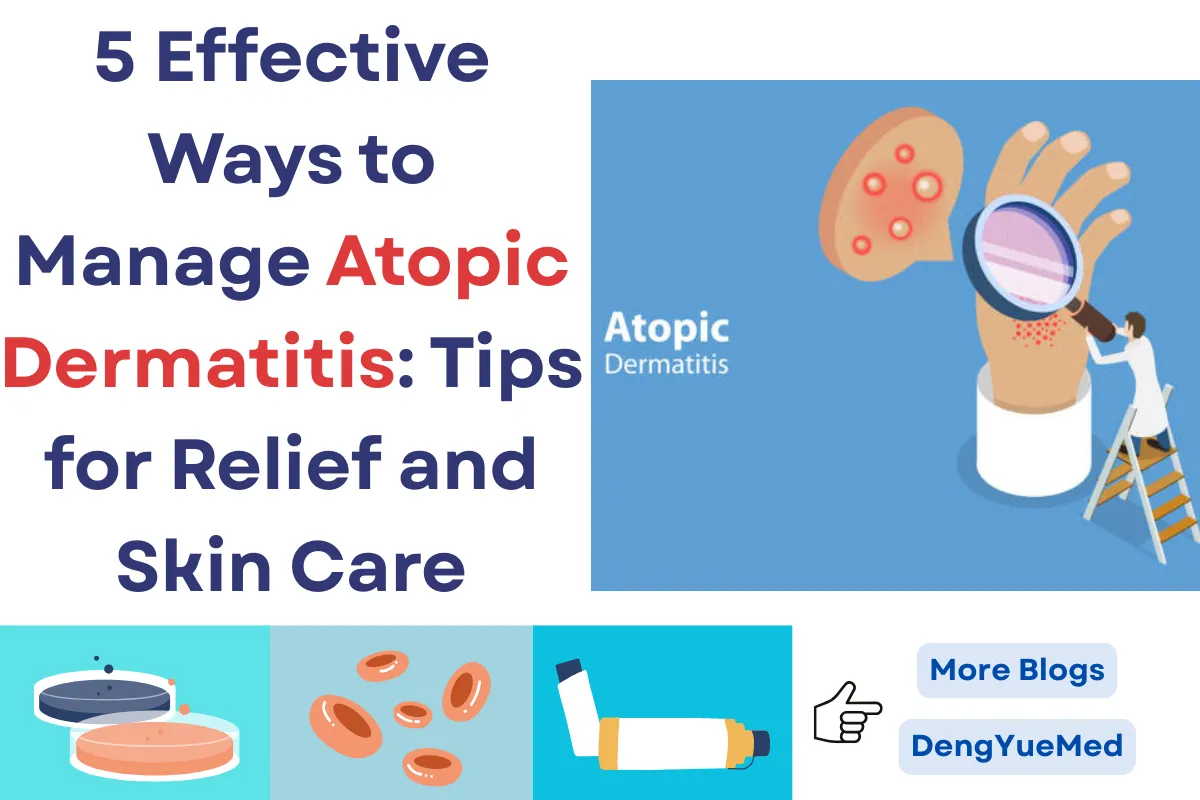 5 Effective Ways to Manage Atopic Dermatitis: Tips for Relief and Skin Care