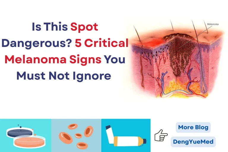 Is This Spot Dangerous? 5 Critical Melanoma Signs You Must Not Ignore 