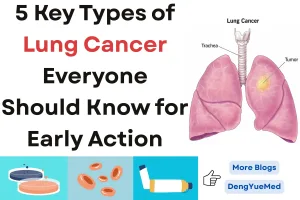 5 key types of lung cancer everyone should know for early action