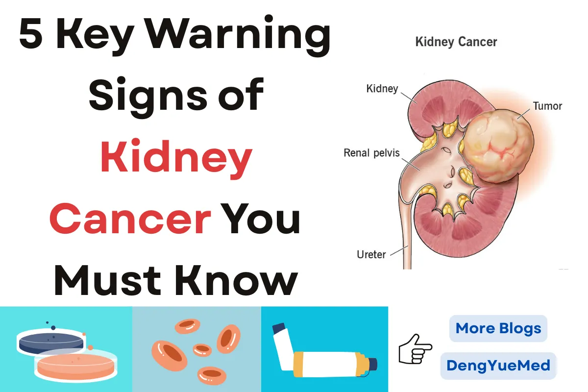 5 Key Warning Signs of Kidney Cancer You Must Know