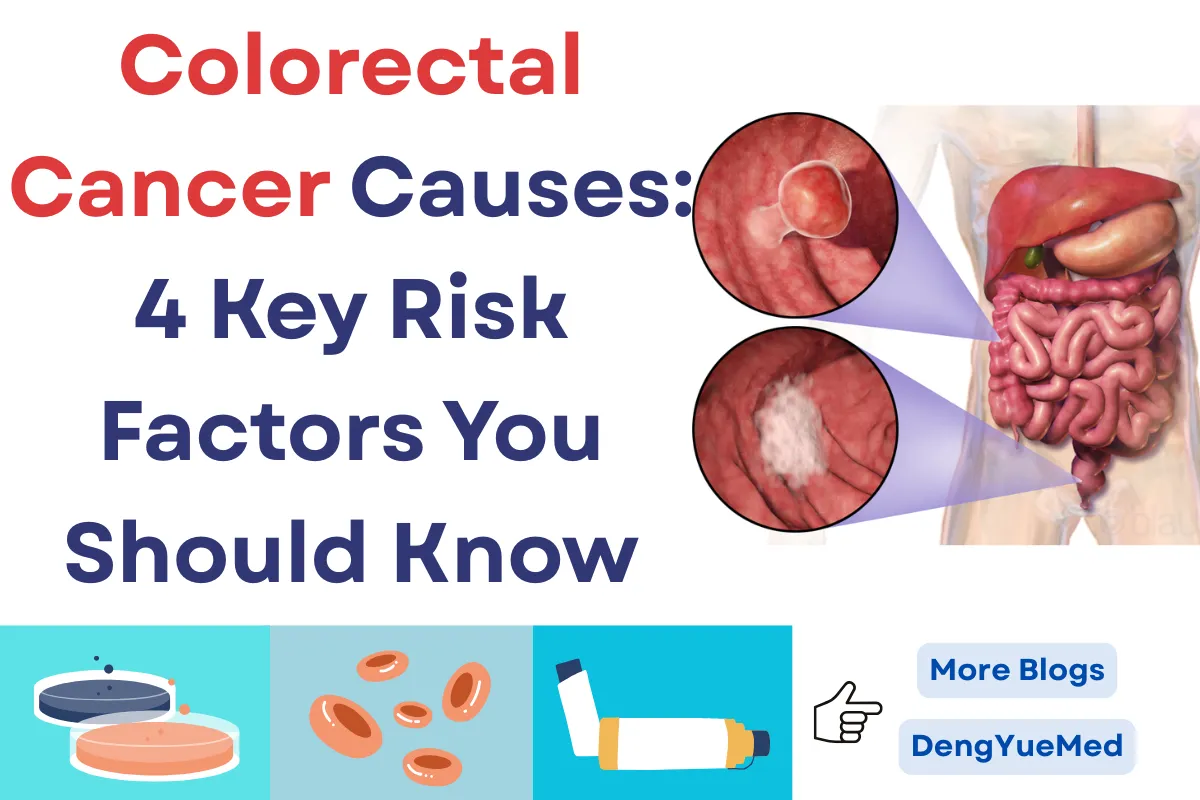 Colorectal Cancer Causes: 4 Key Risk Factors You Should Know Colorectal Cancer Causes: 4 Key Risk Factors You Should Know