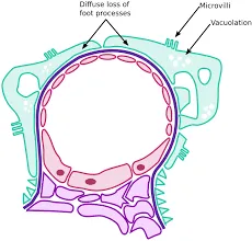 minimal disease activity