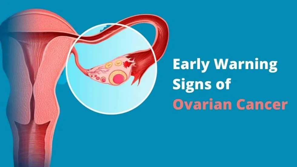 Early Warning Signs of Ovarian Cancer: Don't Ignore Your Body's Silent Cries 1 the signs of Ovarian Cancer