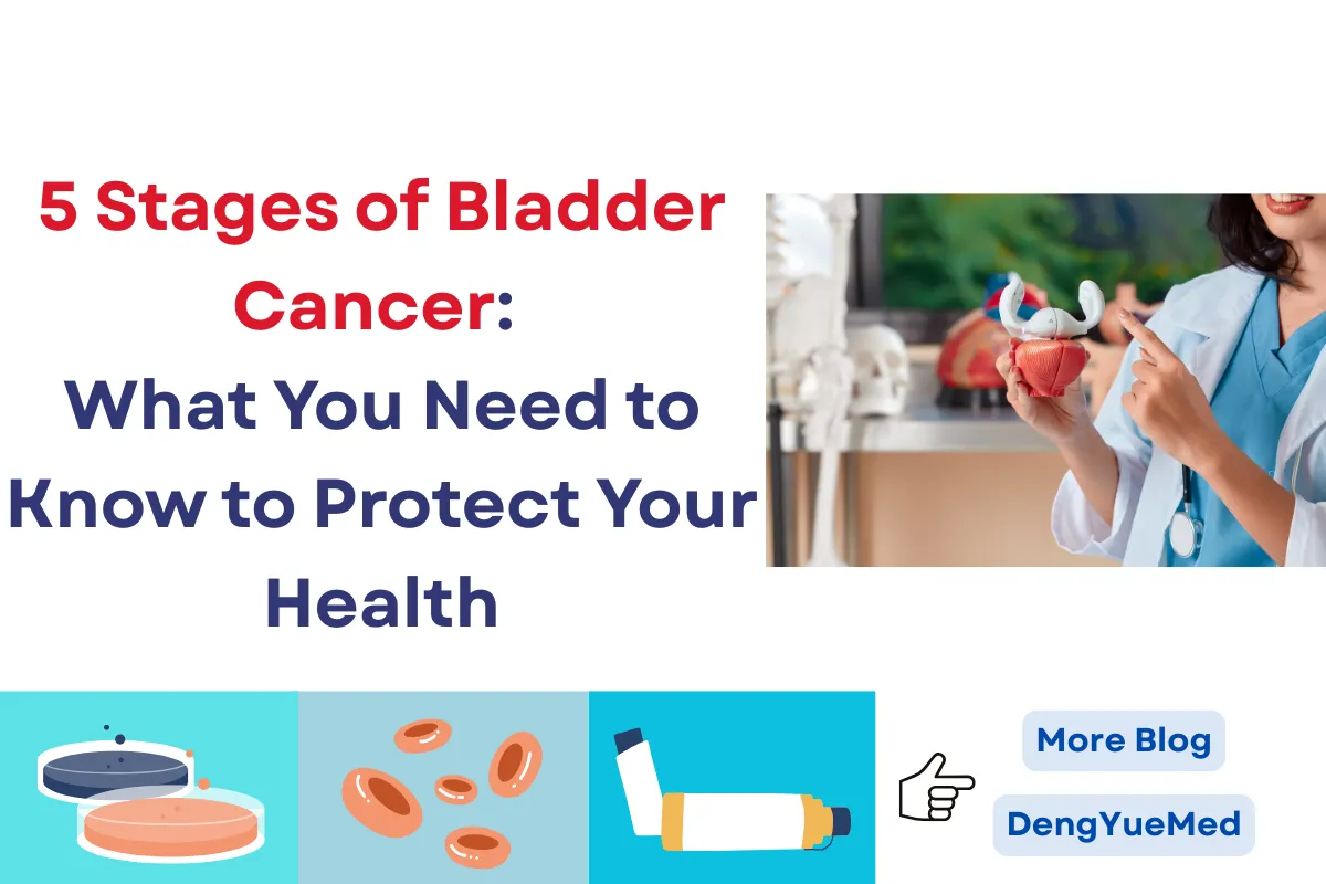 5 Stages of Bladder Cancer: What You Need to Know to Protect Your Health 5 Stages of Bladder Cancer: What You Need to Know to Protect Your Health