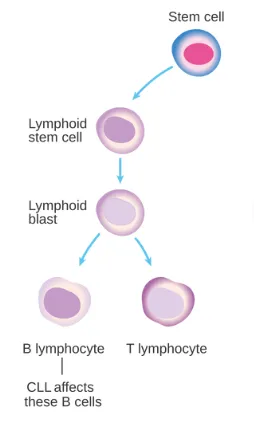 a diagram showing the cells affected by cll