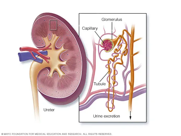 IgA Nephropathy