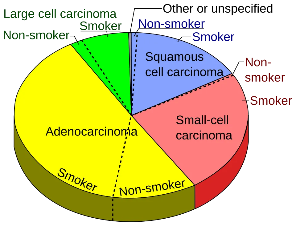 Pie chart of lung cancers