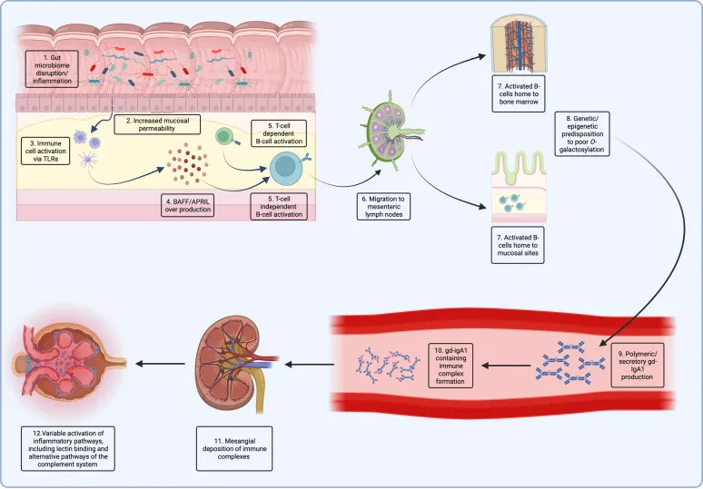 primary iga nephropathy