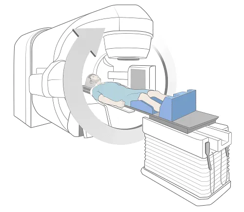 radiation therapy