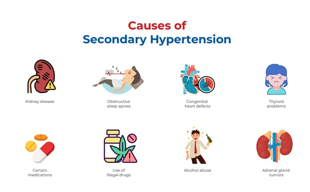 the causes of secondary hypertension