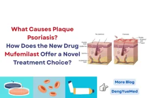 what causes plaque psoriasis how does the new drug mufemilast offer a novel treatment choice