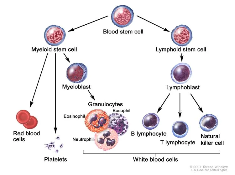 chronic lymphocytic leukemia