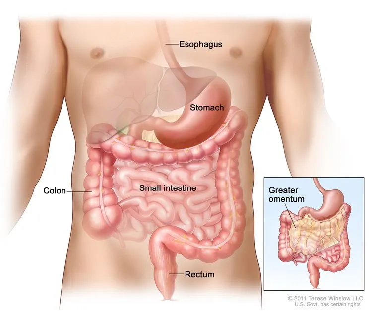 gastrointestinal stromal tumors (GIST)