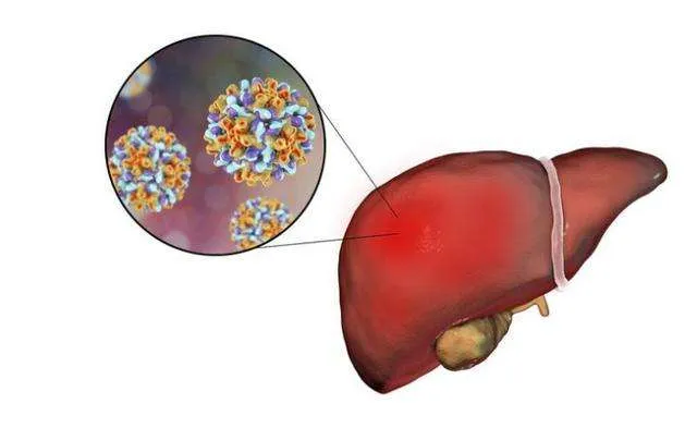 Products 16 hbv-hepatitis-b-virus