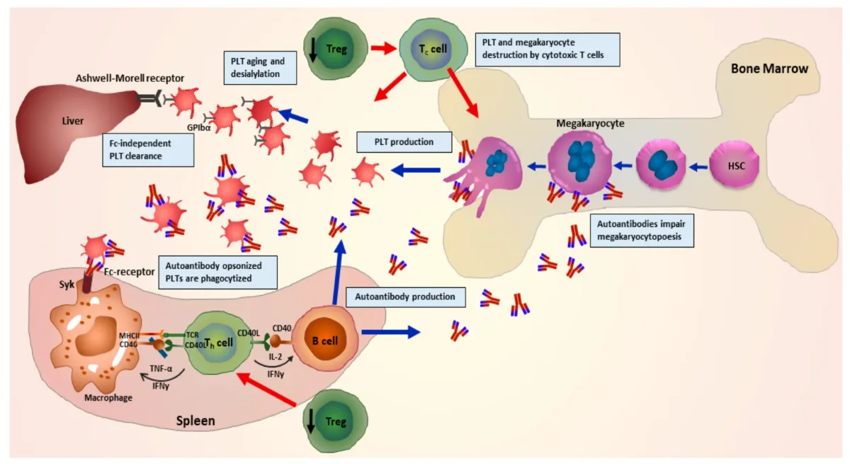 immune thrombocytopenia