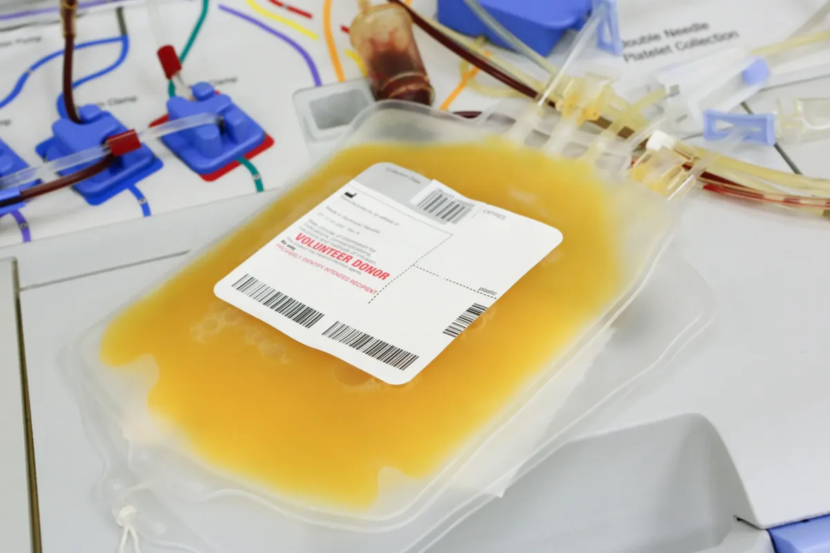 platelet transfusion