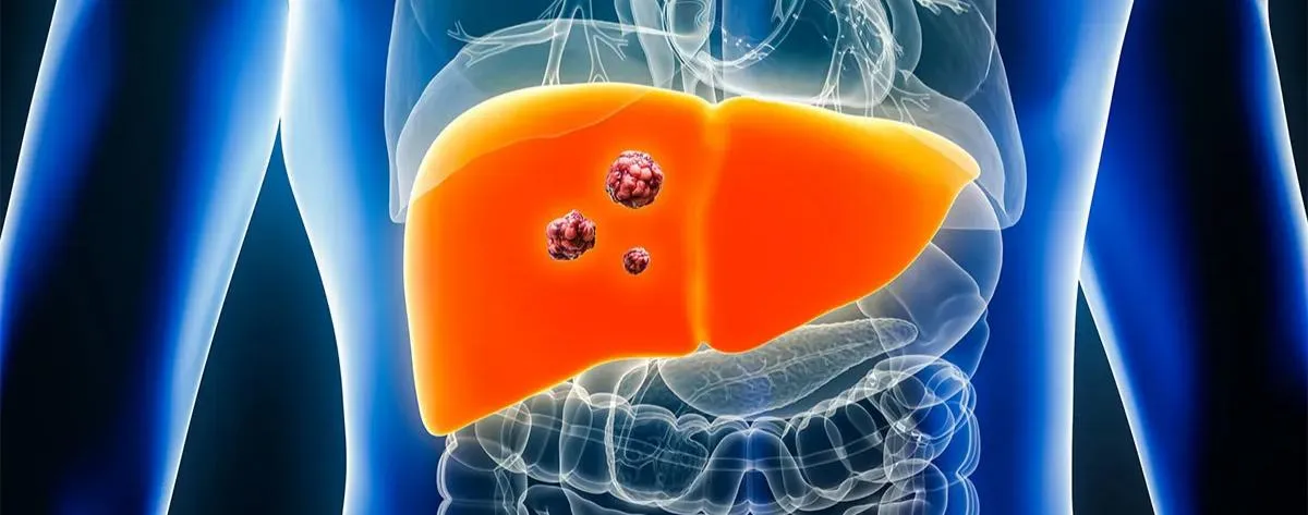 signs of liver cancer diagram