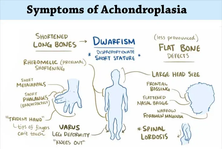 symptoms of achondroplasia