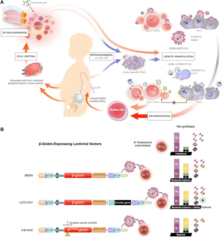 thalassemia gene therapy process hematopoietic stem cells