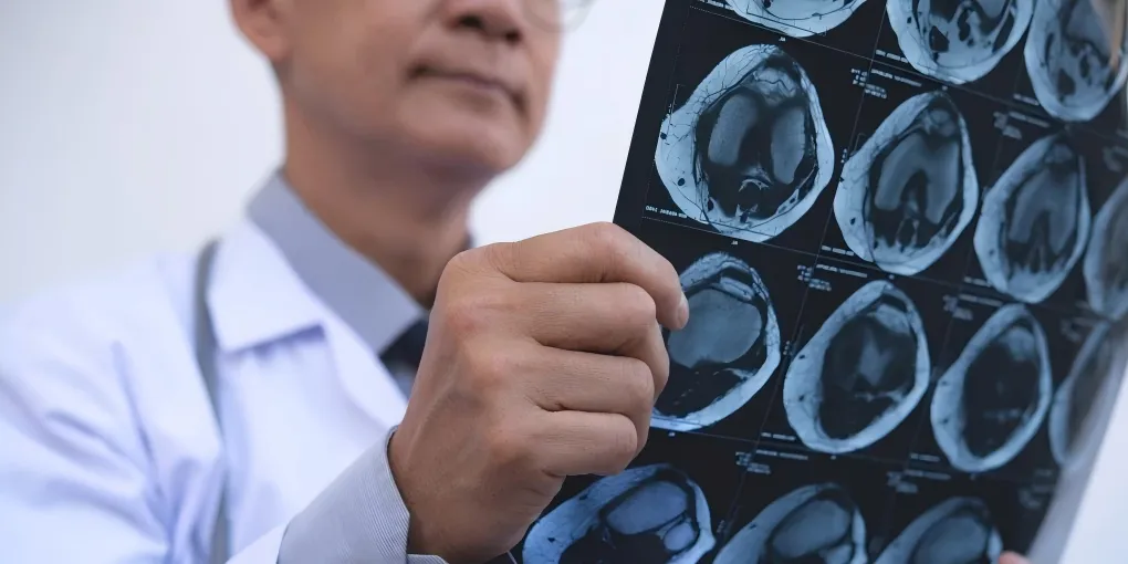 international patients choose China for cancer treatment due to various factors