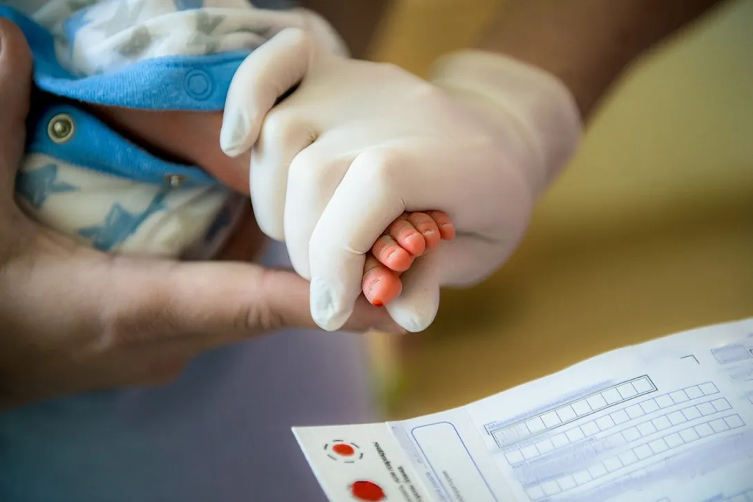 spinal muscular atrophy