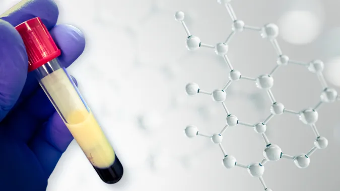 familial chylomicronemia syndrome fcs